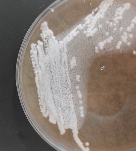 Yeast colonies starting out on agar plates.